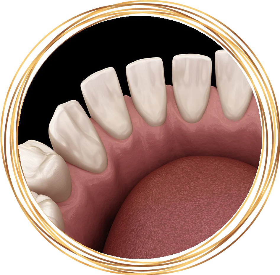 gapped teeth